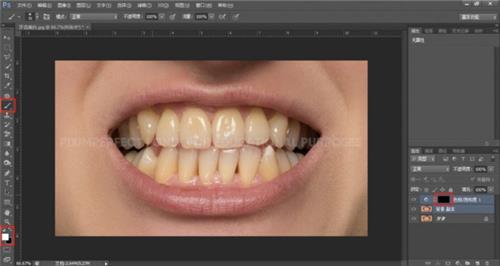 牙齿美化，超级有效的美白牙齿方法_